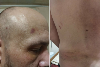 «Тебя просто отработали». Эвакуированный из обстреливаемой Журавлёвки белгородец заявил, что его избили силовики