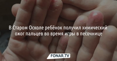 В Старом Осколе ребёнок получил химический ожог пальцев во время игры в песочнице