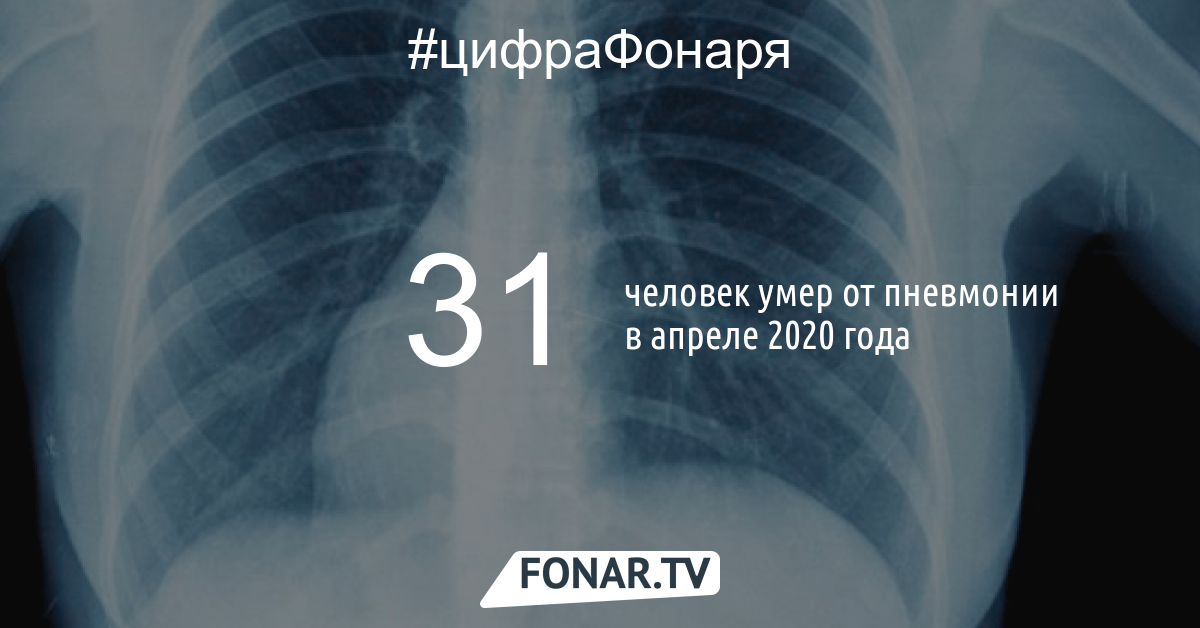 Болезнь 4 дня. Пневмония в Белгородской области в 2021 году.